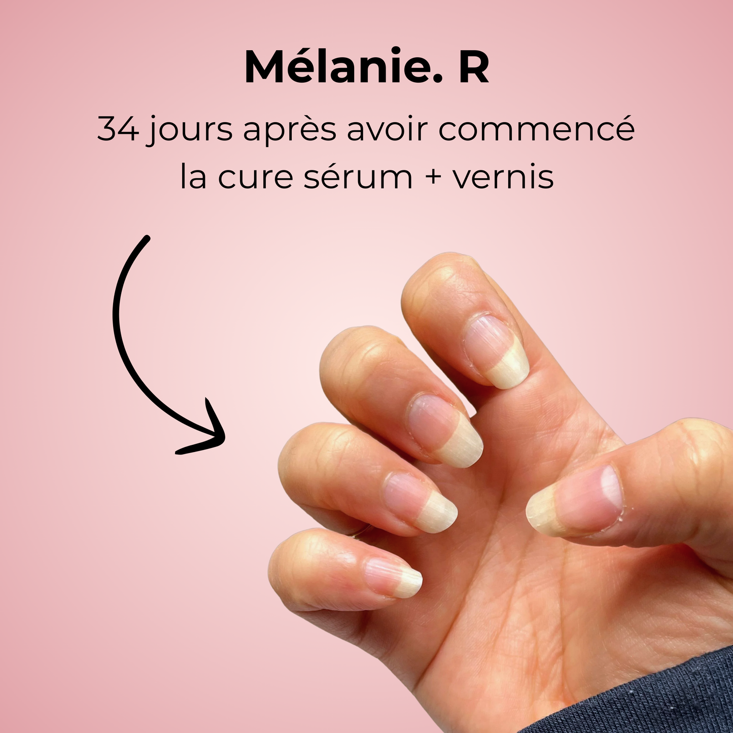 Vernis Protection, Santé & Vitalité | Lyra®